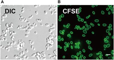 Fluorescent Tracking of Yeast Division Clarifies the Essential Role of Spleen Tyrosine Kinase in the Intracellular Control of Candida glabrata in Macrophages